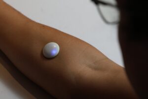 A close‑up of a Biolinq continuous glucose monitor adhered to a wearer’s arm — a new step in needle‑free diabetes technology. (Source: Wall Street Journal)